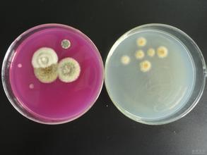 公共場(chǎng)所空氣中微生物